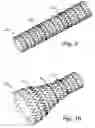 Fig. 08 - Implant device and system for ablation of a vessel's wall from the inside