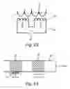 Fig. 16 - Implant device and system for ablation of a vessel's wall from the inside