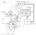 Fig. 01 - Systems and methods for patient-based computer assisted surgical procedures