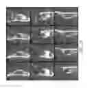 Fig. 22 - Therapeutic tooth bud ablation