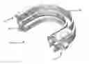 Fig. 01 - Mandibular reposition device and coupling therefor