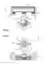 Fig. 04 - Mandibular reposition device and coupling therefor