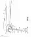Fig. 03 - APPARATUSES FOR EVACUATION OF A ROOT CANAL AND METHODS OF USING SAME