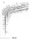 Fig. 05 - APPARATUSES FOR EVACUATION OF A ROOT CANAL AND METHODS OF USING SAME