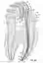 Fig. 10 - APPARATUSES FOR EVACUATION OF A ROOT CANAL AND METHODS OF USING SAME