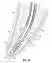 Fig. 12 - APPARATUSES FOR EVACUATION OF A ROOT CANAL AND METHODS OF USING SAME