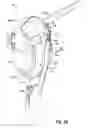 Fig. 47 - APPARATUSES FOR EVACUATION OF A ROOT CANAL AND METHODS OF USING SAME