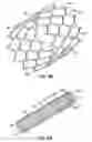 Fig. 60 - APPARATUSES FOR EVACUATION OF A ROOT CANAL AND METHODS OF USING SAME