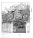 Fig. 10 - Unified three dimensional virtual craniofacial and dentition model and uses thereof