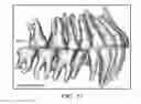 Fig. 12 - Unified three dimensional virtual craniofacial and dentition model and uses thereof