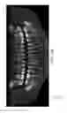 Fig. 45 - Unified three dimensional virtual craniofacial and dentition model and uses thereof