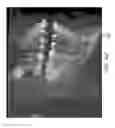 Fig. 46 - Unified three dimensional virtual craniofacial and dentition model and uses thereof