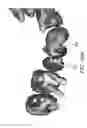 Fig. 49 - Unified three dimensional virtual craniofacial and dentition model and uses thereof