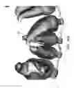 Fig. 50 - Unified three dimensional virtual craniofacial and dentition model and uses thereof