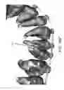 Fig. 52 - Unified three dimensional virtual craniofacial and dentition model and uses thereof