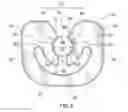 Fig. 06 - Orthodontic gripping device