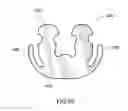Fig. 32 - Orthodontic gripping device