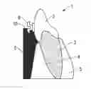 Fig. 01 - Method and tools for indirect bracket positioning