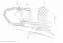 Fig. 01 - Orthodontic bracket