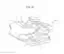 Fig. 08 - Orthodontic bracket