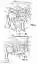 Fig. 02 - Self-ligating orthodontic bracket