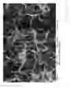 Fig. 06 - PROCESS FOR THE PREPARATION OF A TOPOGRAPHY FOR IMPROVED PROTEIN ADHERENCE ON A BODY MADE OF TITANIUM OR A TITANIUM ALLOY