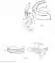 Fig. 02 - Dental appliance design aid