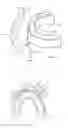 Fig. 03 - Dental appliance design aid