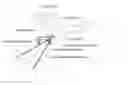 Fig. 01 - Dental implant cleaning systems and methods