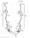 Fig. 01 - Method for providing support to a urethra in treating urinary incontinence