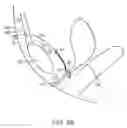 Fig. 10 - Method for providing support to a urethra in treating urinary incontinence