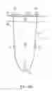 Fig. 12 - Method for providing support to a urethra in treating urinary incontinence