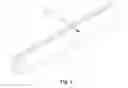Fig. 04 - Intravascular stent and manufacturing method thereof