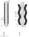 Fig. 04 - Vascular implant