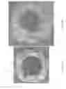Fig. 23 - Vascular implant
