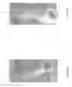 Fig. 24 - Vascular implant