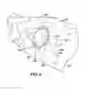 Fig. 03 - Endoluminal prosthesis having multiple branches or fenestrations and methods of deployment