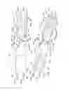 Fig. 07 - Endoluminal prosthesis having multiple branches or fenestrations and methods of deployment