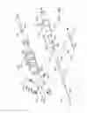 Fig. 08 - Endoluminal prosthesis having multiple branches or fenestrations and methods of deployment