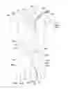 Fig. 14 - Endoluminal prosthesis having multiple branches or fenestrations and methods of deployment