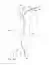 Fig. 15 - Endoluminal prosthesis having multiple branches or fenestrations and methods of deployment