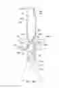 Fig. 30 - Endoluminal prosthesis having multiple branches or fenestrations and methods of deployment