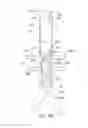 Fig. 32 - Endoluminal prosthesis having multiple branches or fenestrations and methods of deployment