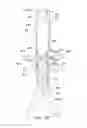 Fig. 33 - Endoluminal prosthesis having multiple branches or fenestrations and methods of deployment