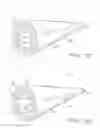 Fig. 09 - Prosthetic Tissue Valves