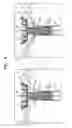 Fig. 12 - Prosthetic valve with leaflet connectors