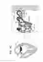 Fig. 16 - Prosthetic valve with leaflet connectors