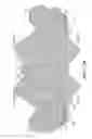 Fig. 23 - Prosthetic valve with leaflet connectors