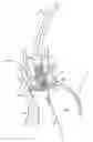 Fig. 01 - Devices, systems and methods to improve placement and prevent heart block with percutaneous aortic valve replacement