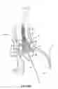 Fig. 41 - Devices, systems and methods to improve placement and prevent heart block with percutaneous aortic valve replacement